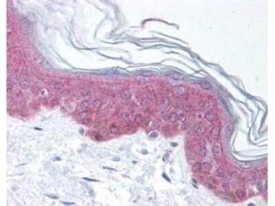 Immunohistochemistry: ASAP1 [p Tyr782] Antibody [NBP1-77933]